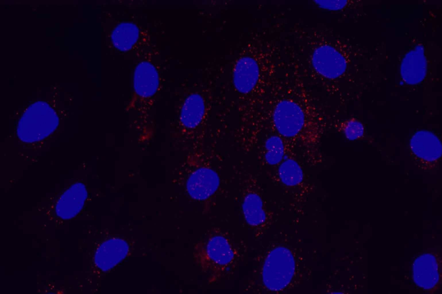 EGFR-Her2 complex formation in EGF-treated cancer cells