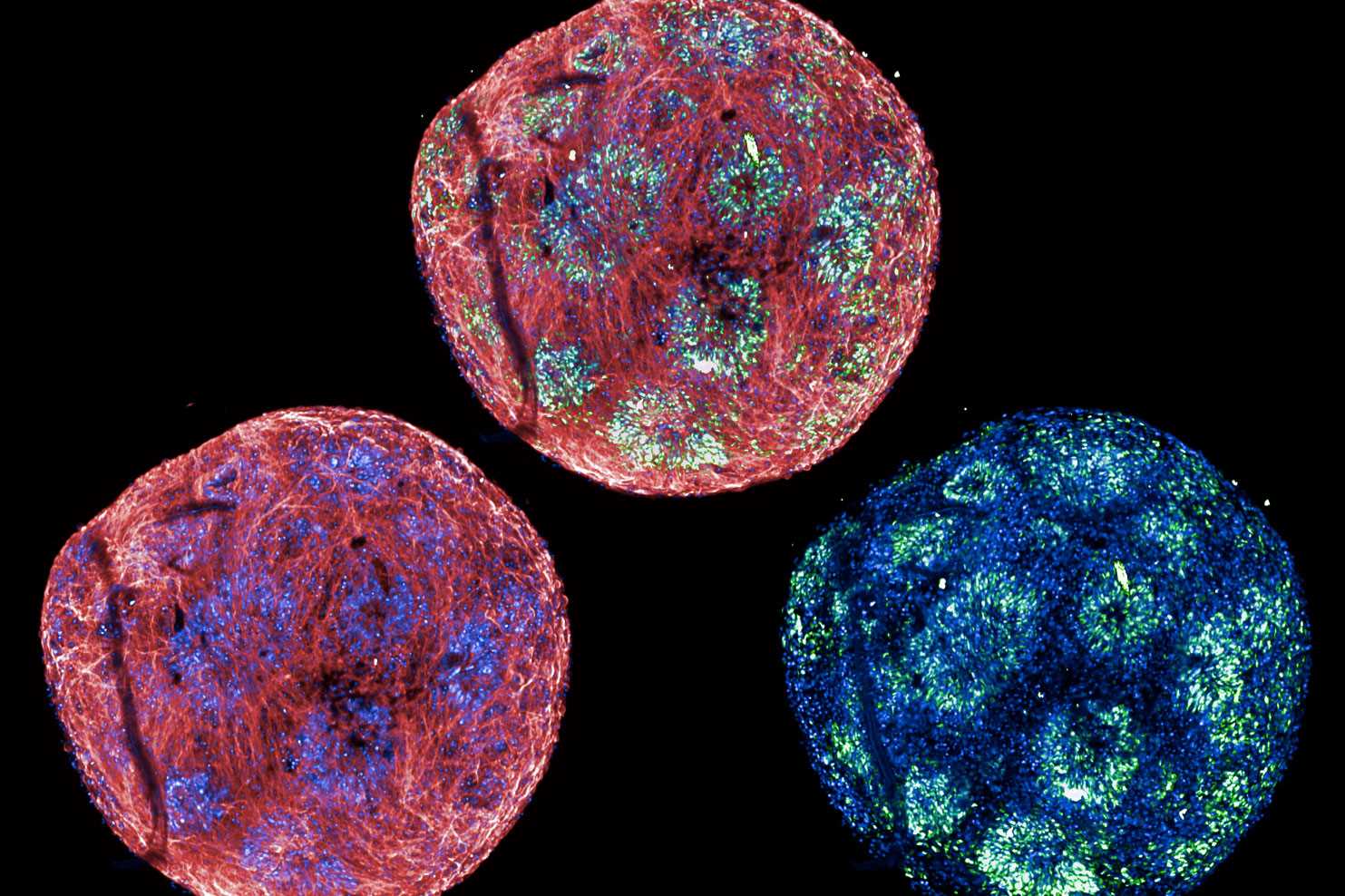 Staining of fate markers in human brain organoids grown in 384-well format 