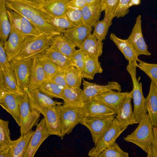 Cells stained with Cell Painting workflow