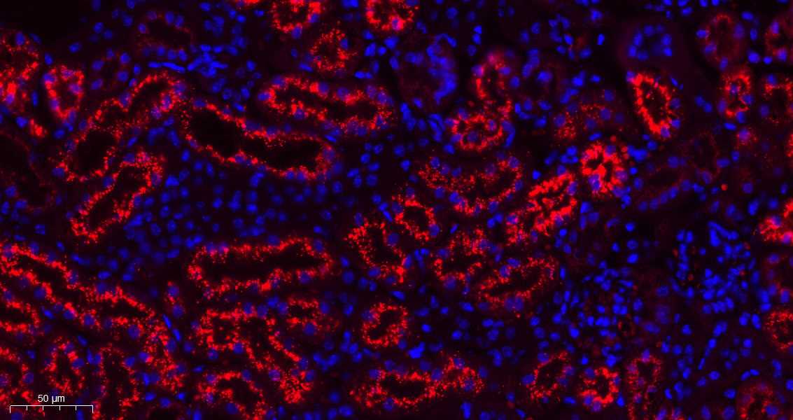 Sepcific detection of nucleid labeled nucleic acids in cortical tubules