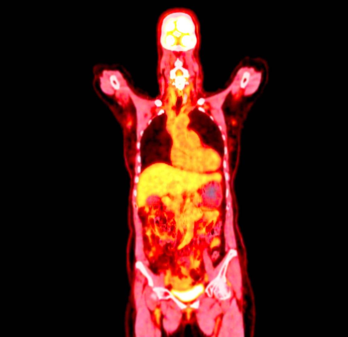 in vivo fibrosis and metabolic disease