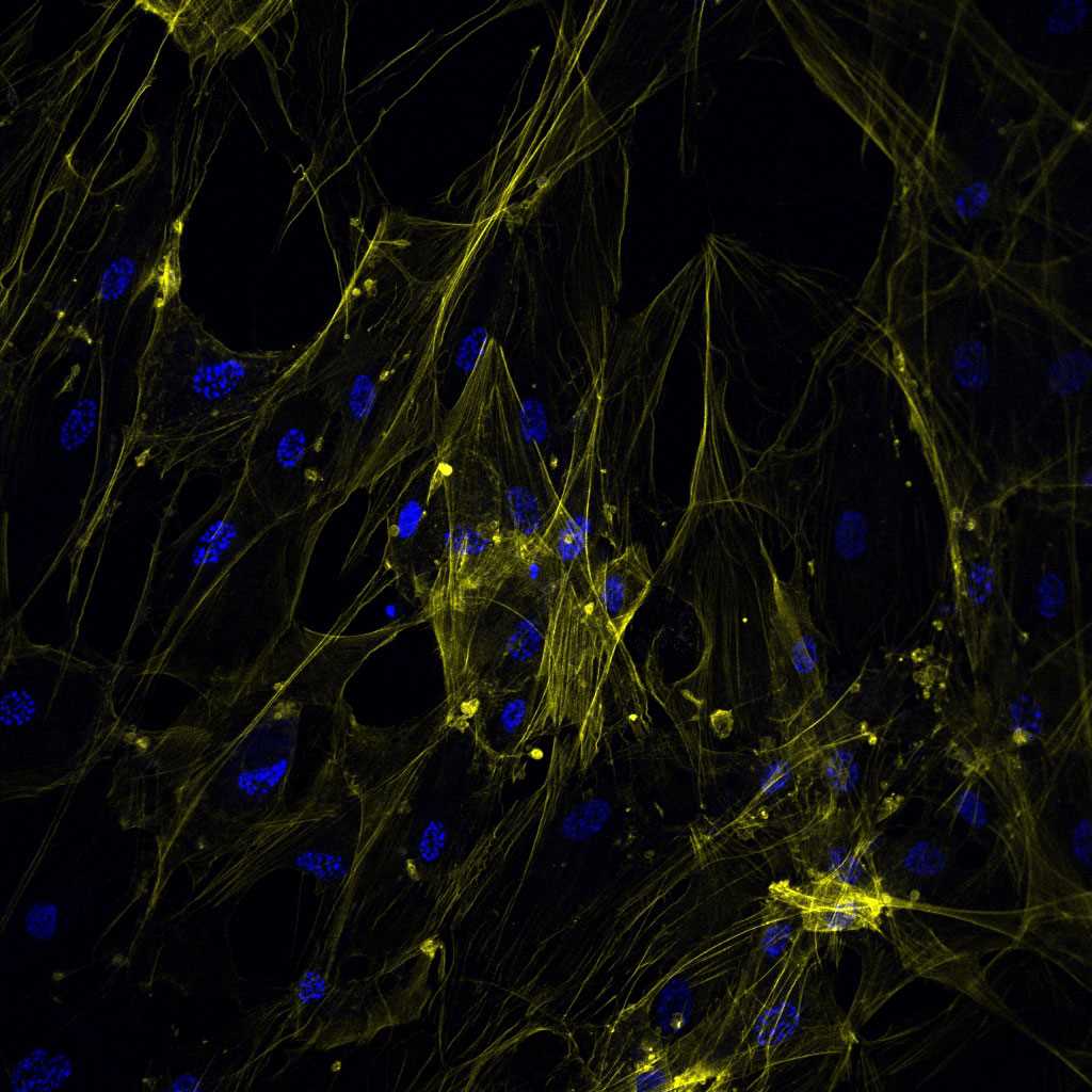 High content analysis of tissue culture.