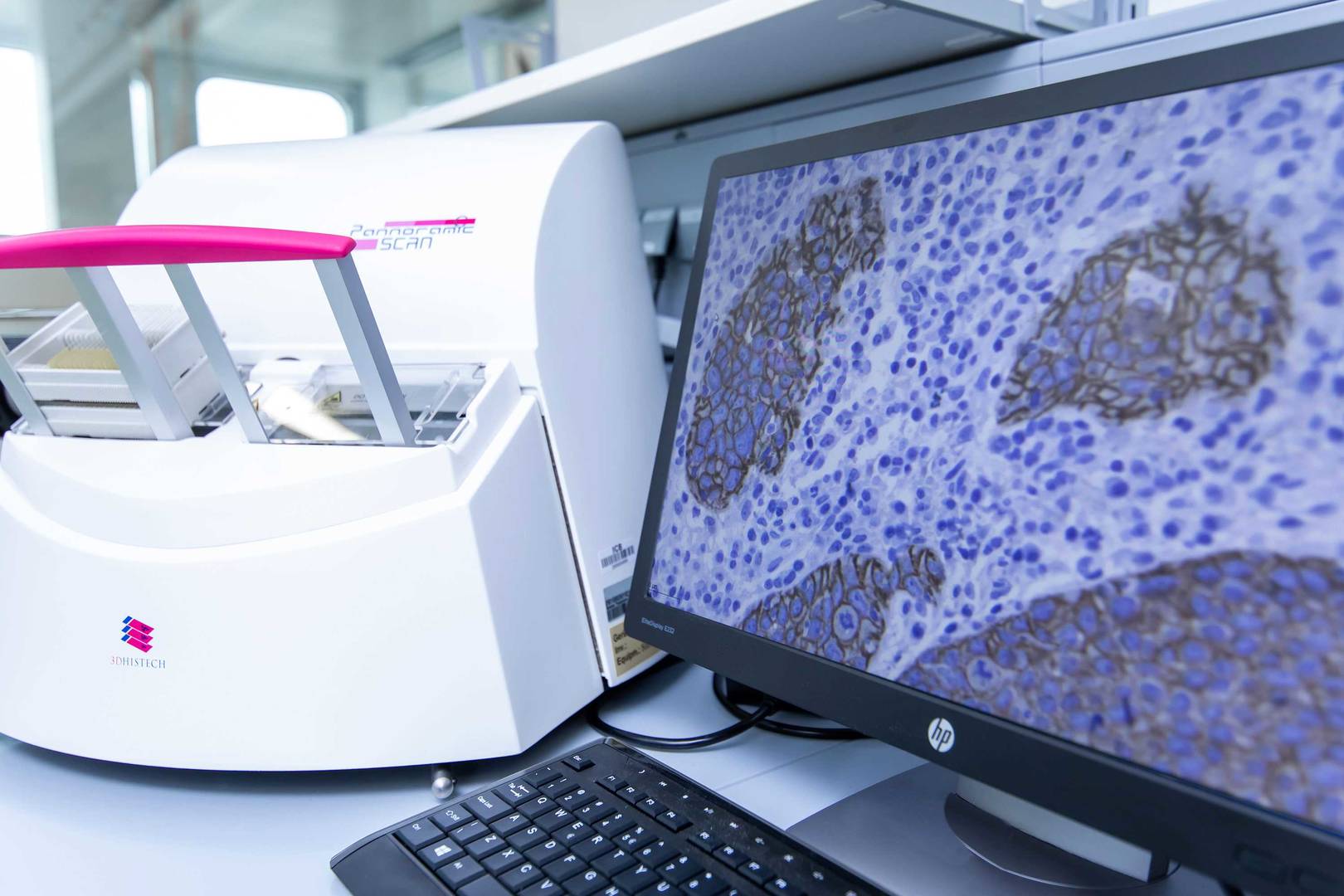 A computer screen showing histological microscopy image, auto imager in the background