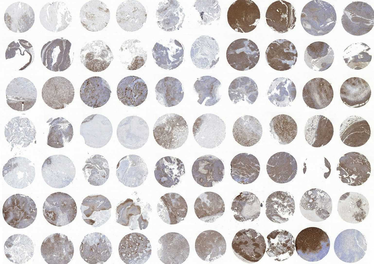 Indication profiling using tumor microarrays