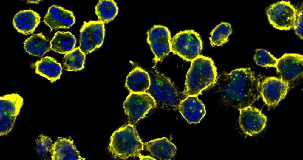 Human immune cells stained with a fluorescently labelled antibody