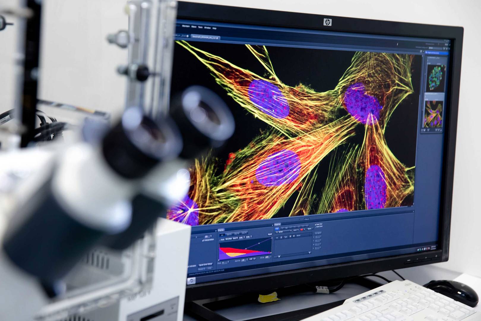 Immunostaining of subcellular features