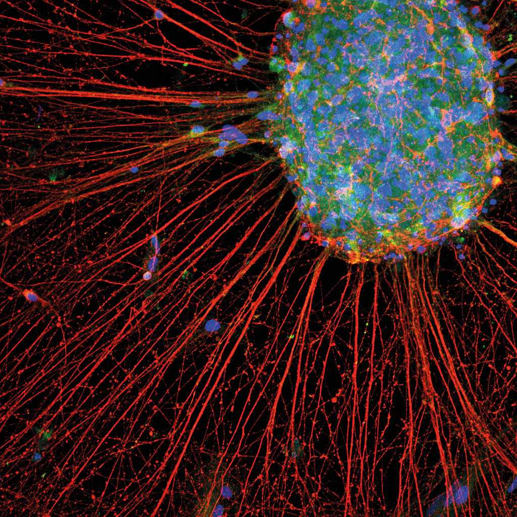 Immunofluorescent image of human iPSC-derived nociceptor neurons stained for TrkA and MAP2