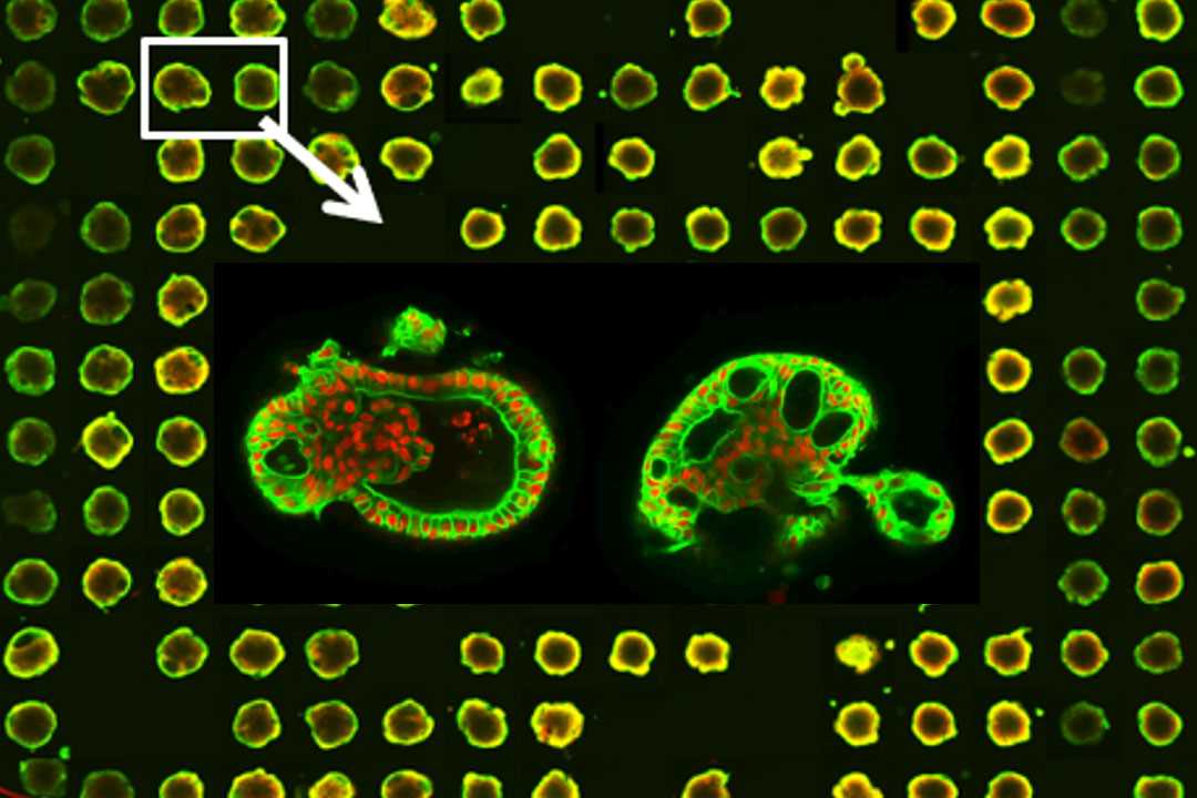 Assessing kidney organoid morphology using high-throughput high-content imaging