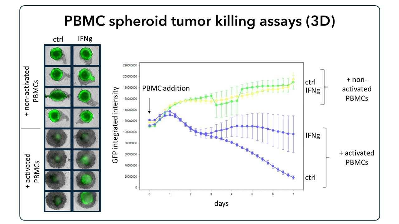 IFNgamma-pretreated cancer cells form spheroids on low-attachment plates; PBMCs added to assess spheroid viability via Incucyte