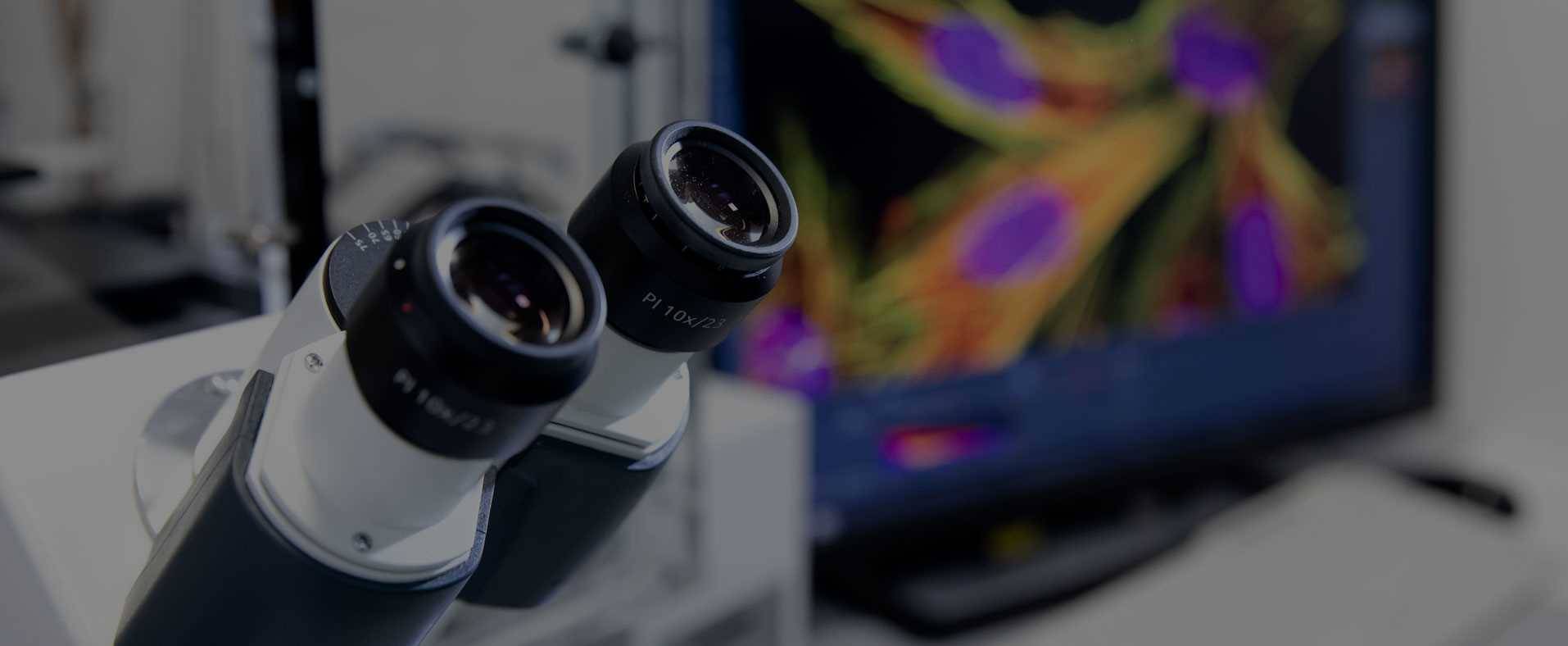 Immunostaining of subcellular features