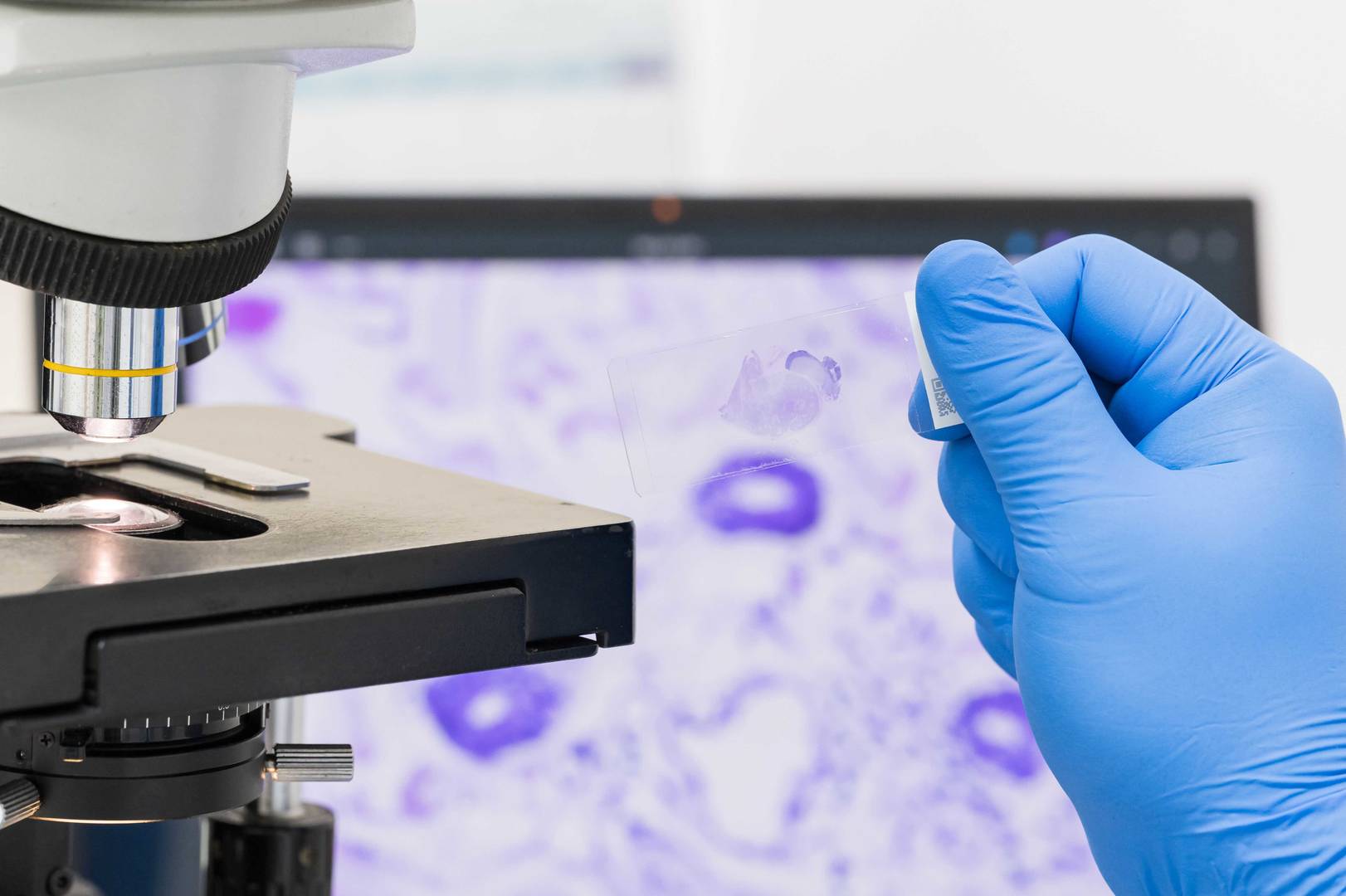 A scientist's hand holds a microscopy slide with a tissue specimen, with a microscope and computer screen in the background.